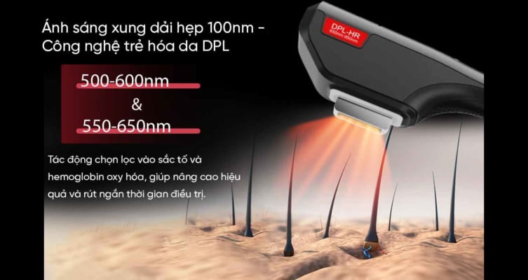 MÁY TRIỆT LÔNG DPL 12